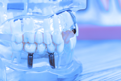 Anatomy of teeth